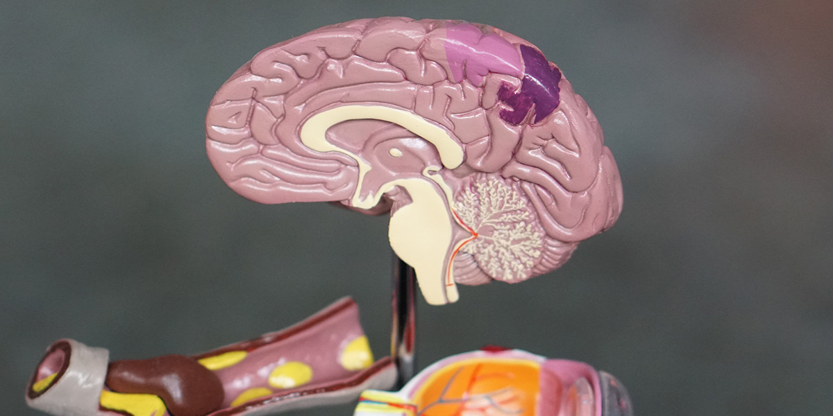 McLarty_Feature Image02 Brain Statue Sample | McLarty Wolf Litigation Lawyers